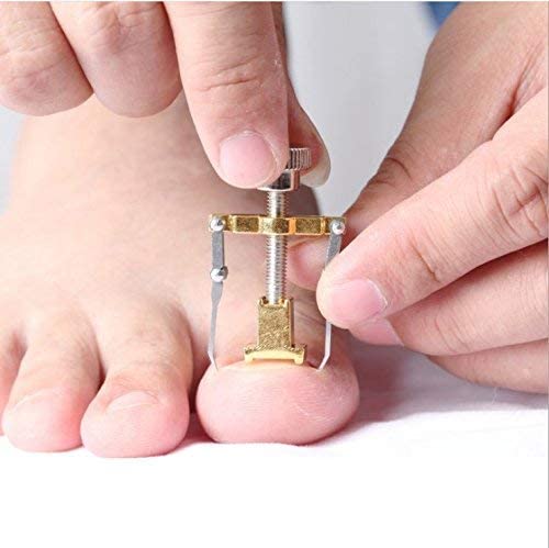 أداة تصحيح أظافر القدم واليد لتعود لوضعها الطبيعي والتخلص من الألم